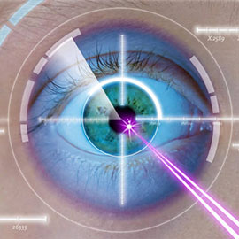 Lazer Göz Ameliyatı