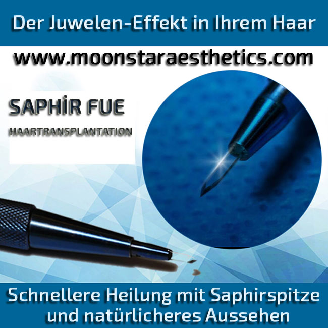 Saphir-Fue-Haartransplantation