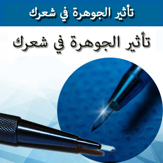 زراعة الشعر بالياقوت