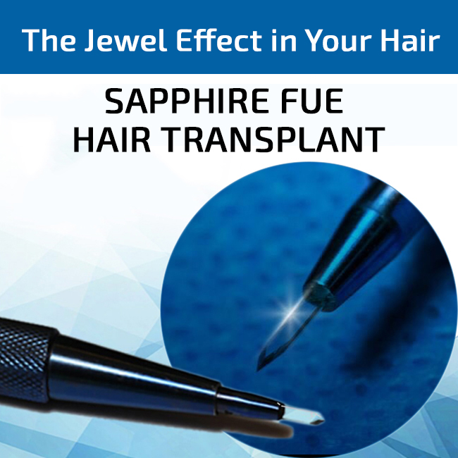 Sapphire Fue Hair Transplant